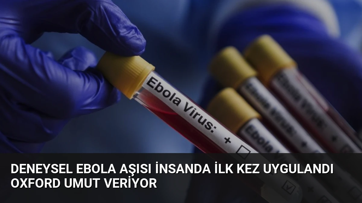 Deneysel Ebola Aşısı İnsanda İlk Kez Uygulandı Oxford Umut Veriyor